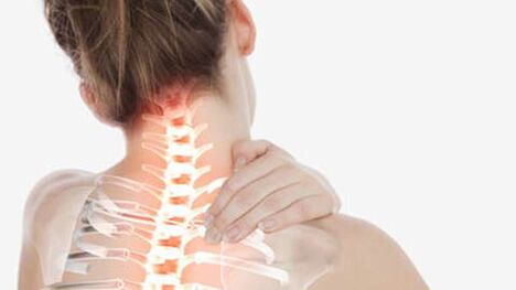 Bizkarrezurreko bizkarrezurraren osteokondrosia