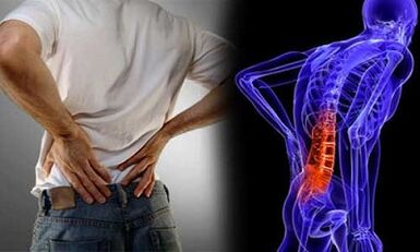 Lumbar osteochondrosisaren garapenaren arrazoiak